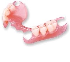 Partial denture, removable, without metal attachment